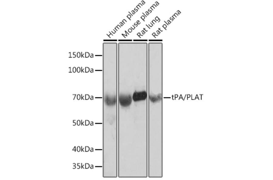 Western Blot - Anti-Tissue Plasminogen Activator Antibody [ARC0928] (A306616) - Antibodies.com