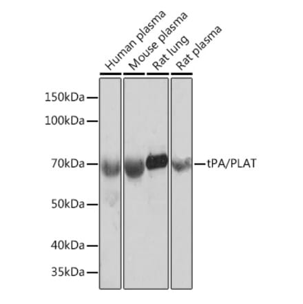 Western Blot - Anti-Tissue Plasminogen Activator Antibody [ARC0928] (A306616) - Antibodies.com