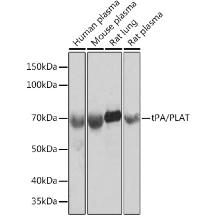 Western Blot - Anti-Tissue Plasminogen Activator Antibody [ARC0928] (A306616) - Antibodies.com