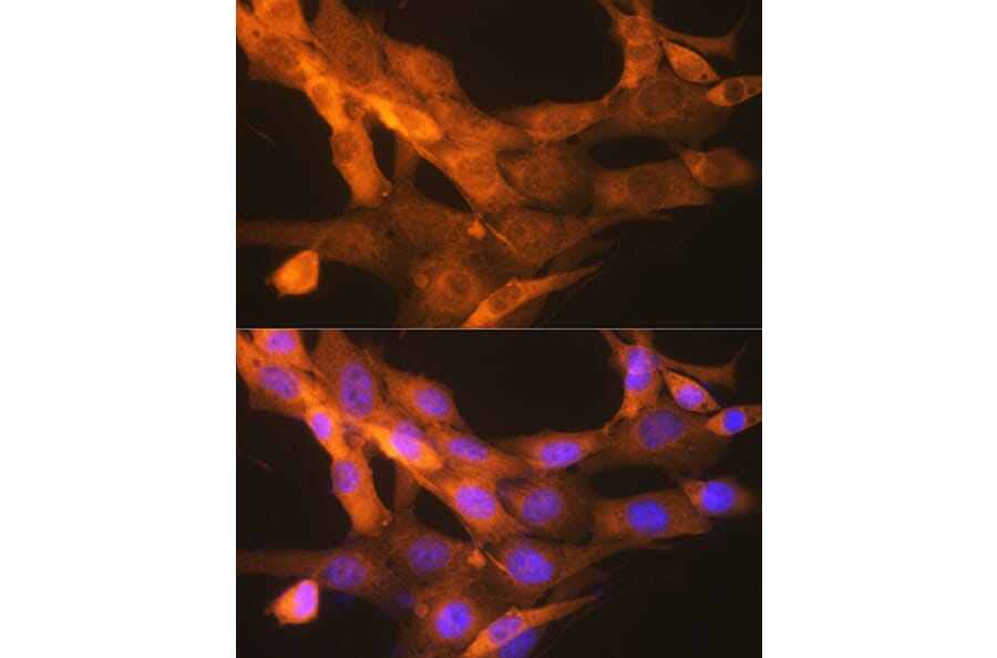 Immunofluorescence - Anti-Tissue Plasminogen Activator Antibody [ARC0928] (A306616) - Antibodies.com