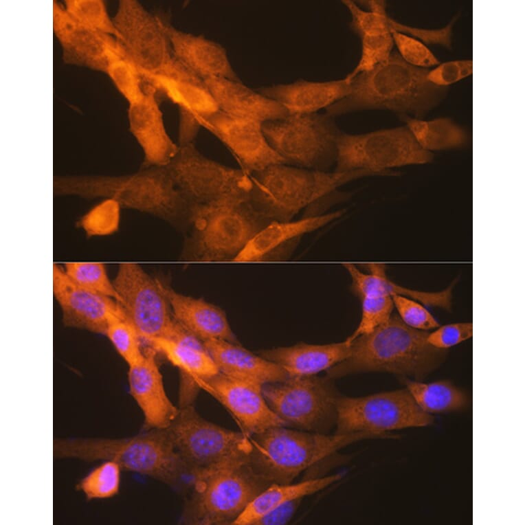 Immunofluorescence - Anti-Tissue Plasminogen Activator Antibody [ARC0928] (A306616) - Antibodies.com