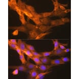 Immunofluorescence - Anti-Tissue Plasminogen Activator Antibody [ARC0928] (A306616) - Antibodies.com