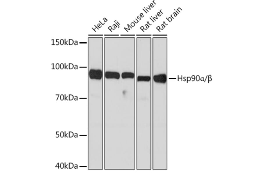 Western Blot - Anti-Hsp90 alpha + Hsp90 beta Antibody [ARC1169] (A306617) - Antibodies.com