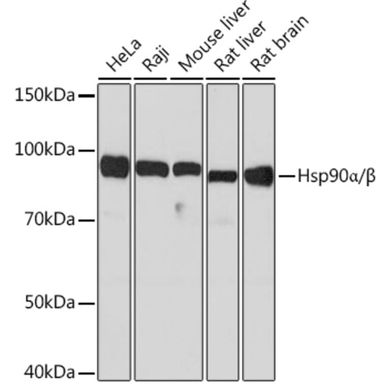 Western Blot - Anti-Hsp90 alpha + Hsp90 beta Antibody [ARC1169] (A306617) - Antibodies.com