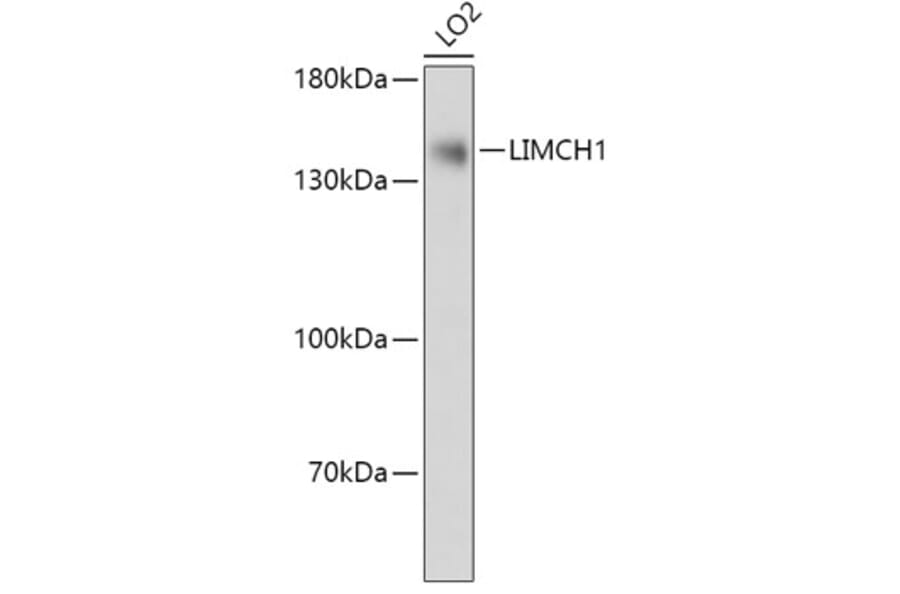 Western Blot - Anti-LIMCH1 Antibody (A306618) - Antibodies.com