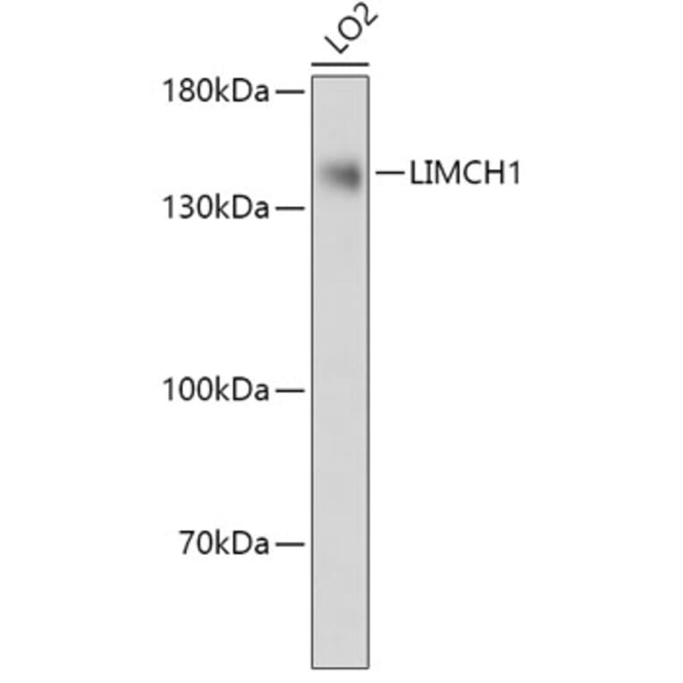 Western Blot - Anti-LIMCH1 Antibody (A306618) - Antibodies.com
