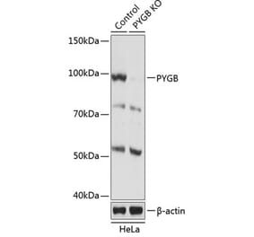 Western Blot - Anti-GPBB Antibody (A306619) - Antibodies.com