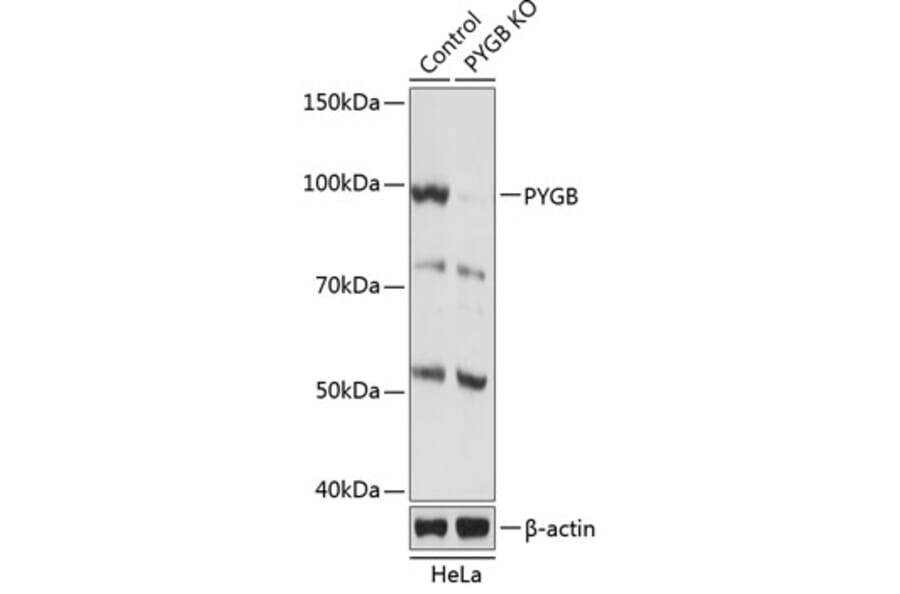 Western Blot - Anti-GPBB Antibody (A306619) - Antibodies.com