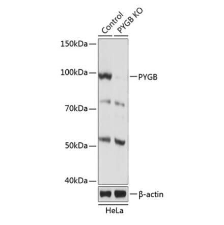 Western Blot - Anti-GPBB Antibody (A306619) - Antibodies.com