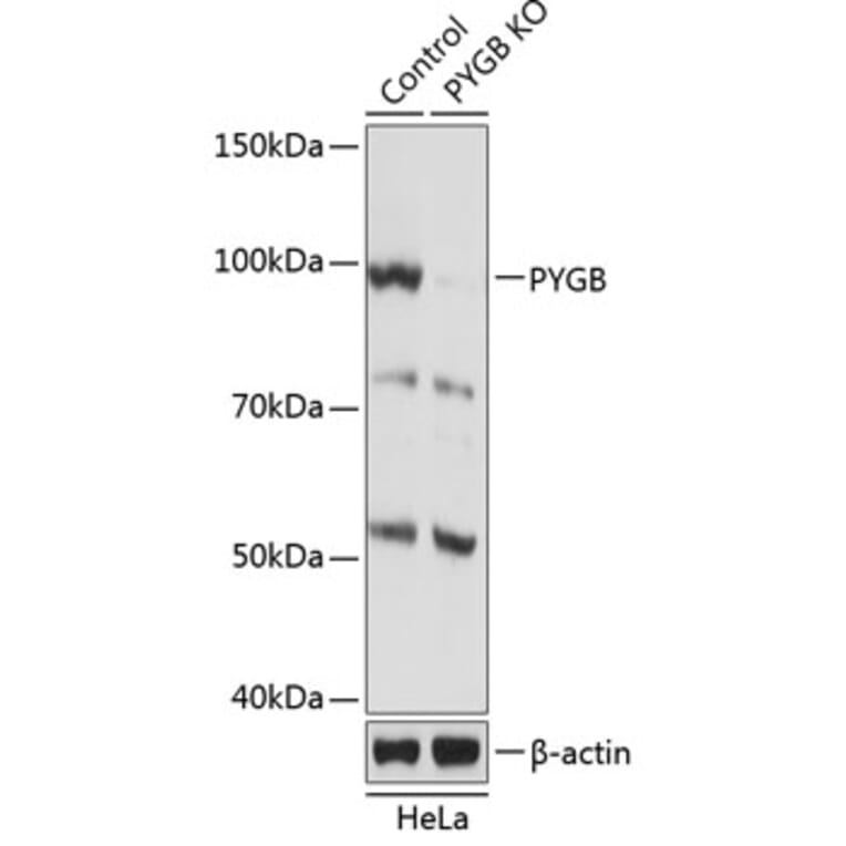 Western Blot - Anti-GPBB Antibody (A306619) - Antibodies.com