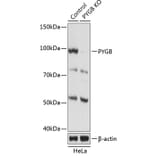 Western Blot - Anti-GPBB Antibody (A306619) - Antibodies.com