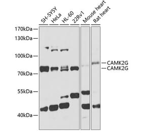 Western Blot - Anti-CamKII gamma Antibody (A306620) - Antibodies.com