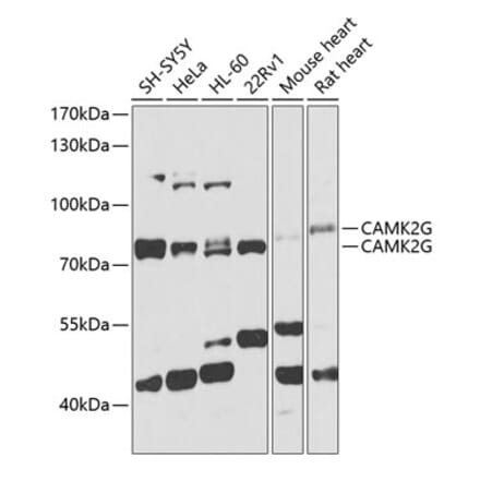 Western Blot - Anti-CamKII gamma Antibody (A306620) - Antibodies.com