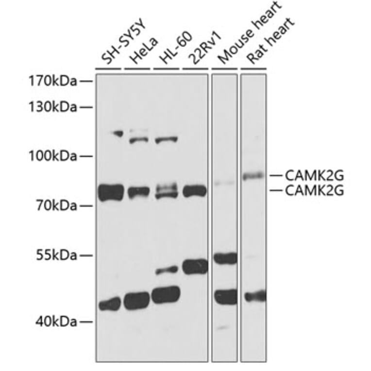 Western Blot - Anti-CamKII gamma Antibody (A306620) - Antibodies.com