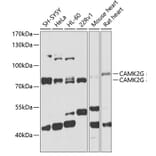 Western Blot - Anti-CamKII gamma Antibody (A306620) - Antibodies.com