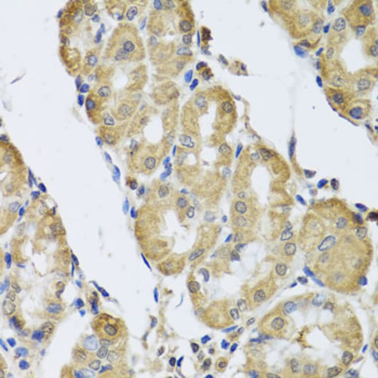 Immunohistochemistry - Anti-CamKII gamma Antibody (A306620) - Antibodies.com