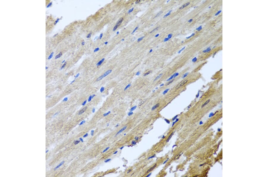 Immunohistochemistry - Anti-CamKII gamma Antibody (A306620) - Antibodies.com