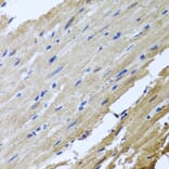 Immunohistochemistry - Anti-CamKII gamma Antibody (A306620) - Antibodies.com