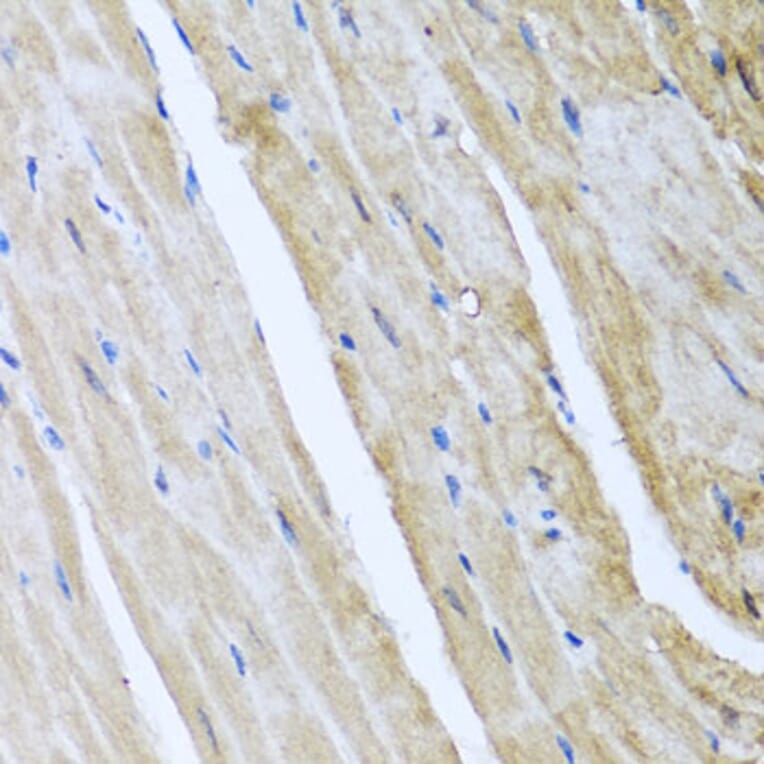 Immunohistochemistry - Anti-CamKII gamma Antibody (A306620) - Antibodies.com