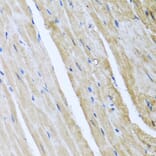 Immunohistochemistry - Anti-CamKII gamma Antibody (A306620) - Antibodies.com