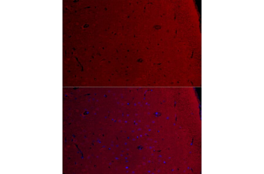 Immunofluorescence - Anti-CamKII gamma Antibody (A306620) - Antibodies.com
