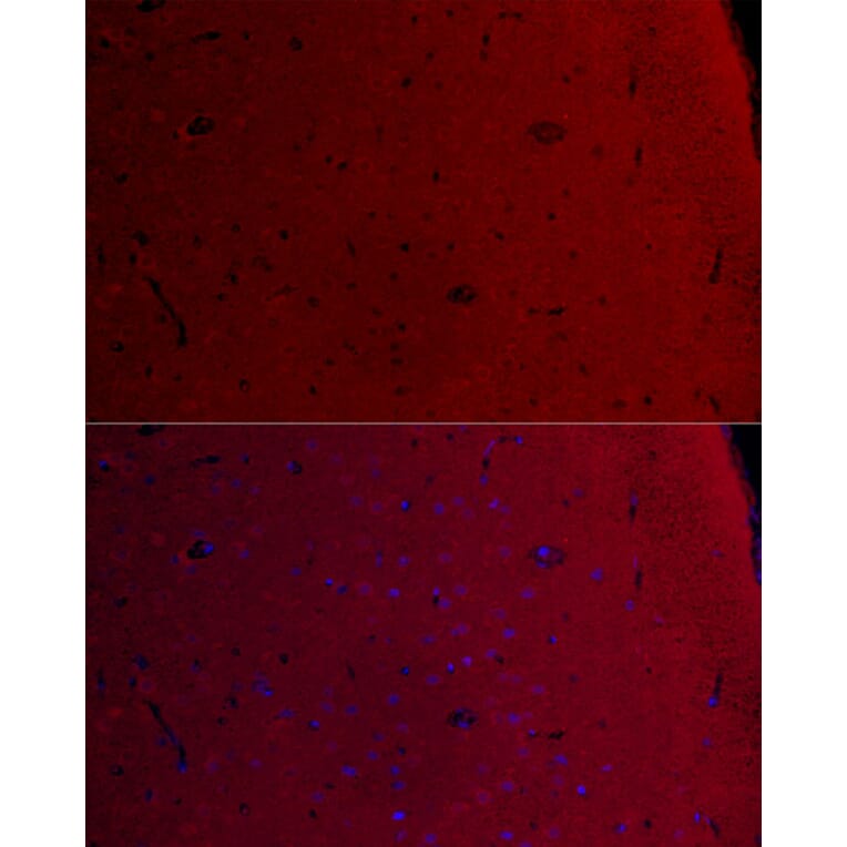 Immunofluorescence - Anti-CamKII gamma Antibody (A306620) - Antibodies.com