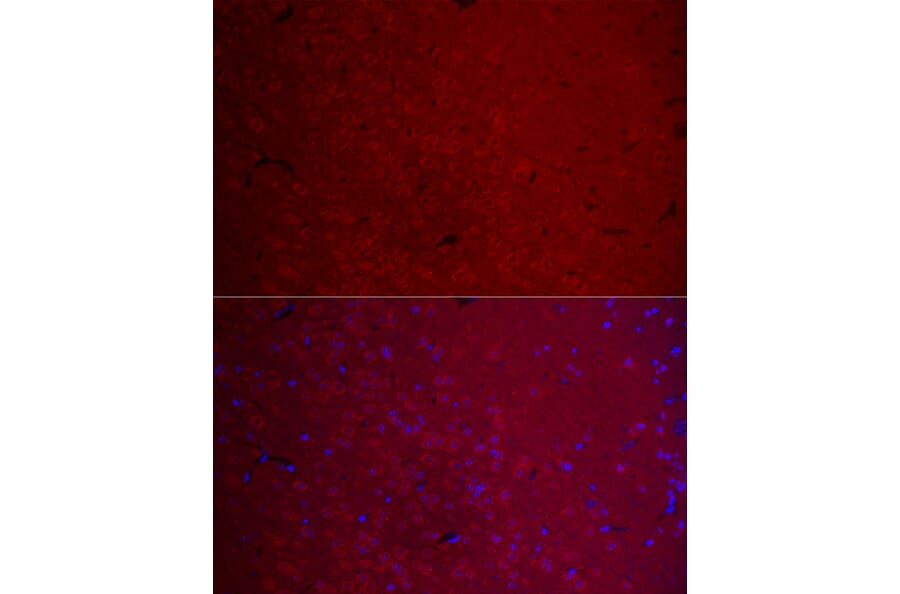 Immunofluorescence - Anti-CamKII gamma Antibody (A306620) - Antibodies.com