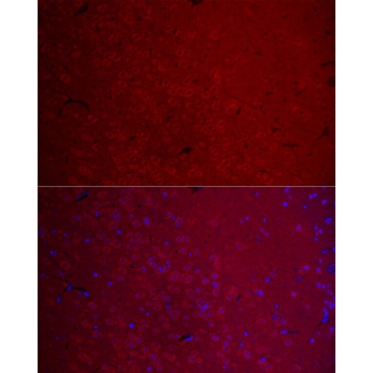 Immunofluorescence - Anti-CamKII gamma Antibody (A306620) - Antibodies.com