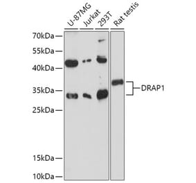 Western Blot - Anti-NC2 alpha Antibody (A306621) - Antibodies.com