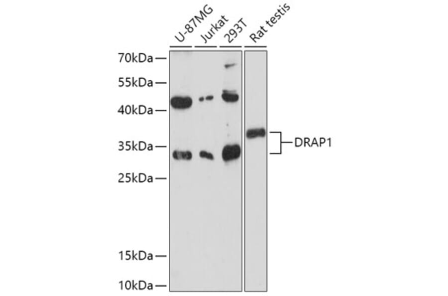 Western Blot - Anti-NC2 alpha Antibody (A306621) - Antibodies.com