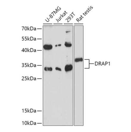 Western Blot - Anti-NC2 alpha Antibody (A306621) - Antibodies.com