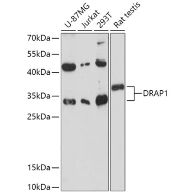 Western Blot - Anti-NC2 alpha Antibody (A306621) - Antibodies.com