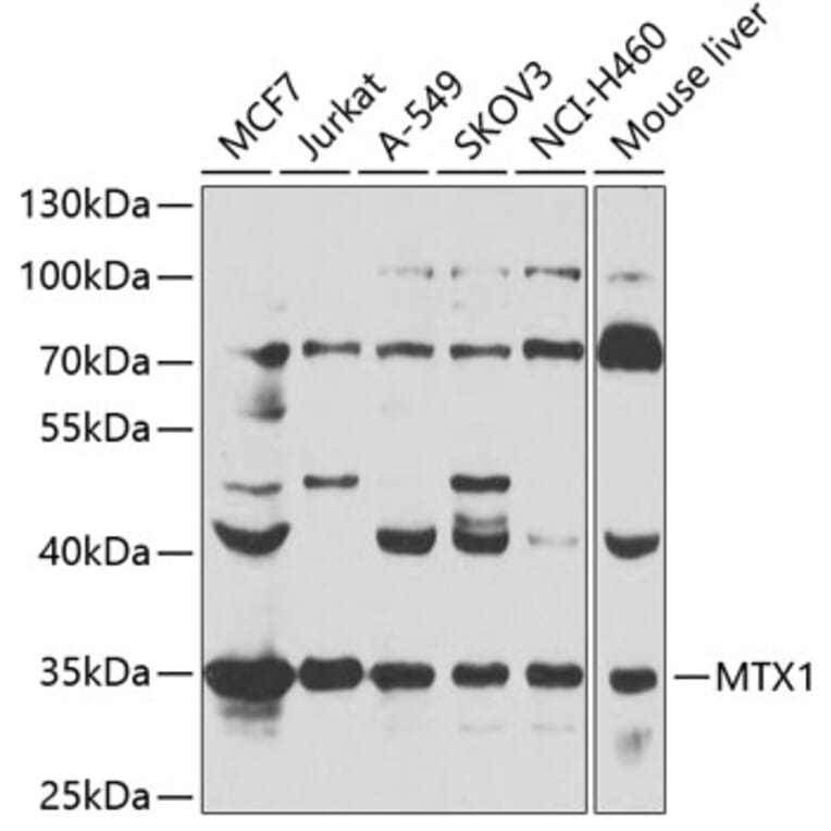 Western Blot - Anti-MTX1 / MTX Antibody (A306624) - Antibodies.com