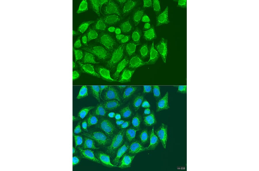 Immunofluorescence - Anti-MTX1 / MTX Antibody (A306624) - Antibodies.com