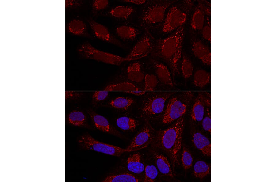 Immunofluorescence - Anti-MTX1 / MTX Antibody (A306624) - Antibodies.com