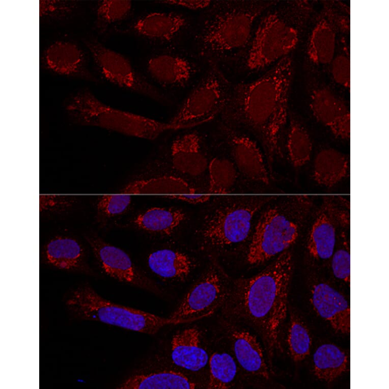 Immunofluorescence - Anti-MTX1 / MTX Antibody (A306624) - Antibodies.com