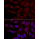 Immunofluorescence - Anti-MTX1 / MTX Antibody (A306624) - Antibodies.com