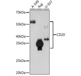 Western Blot - Anti-CD20 Antibody [ARC51683] (A306625) - Antibodies.com