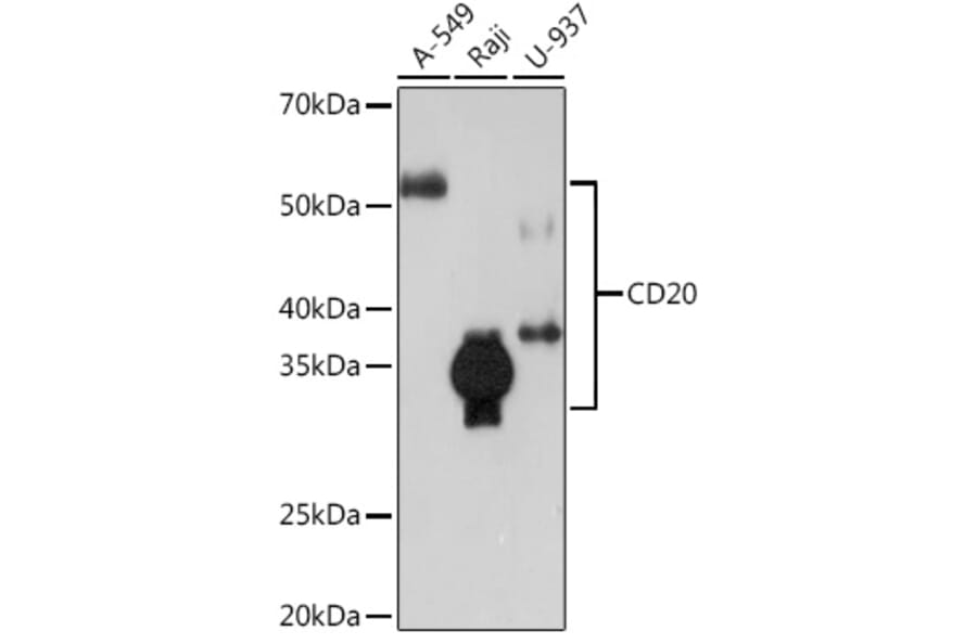 Western Blot - Anti-CD20 Antibody [ARC51683] (A306625) - Antibodies.com