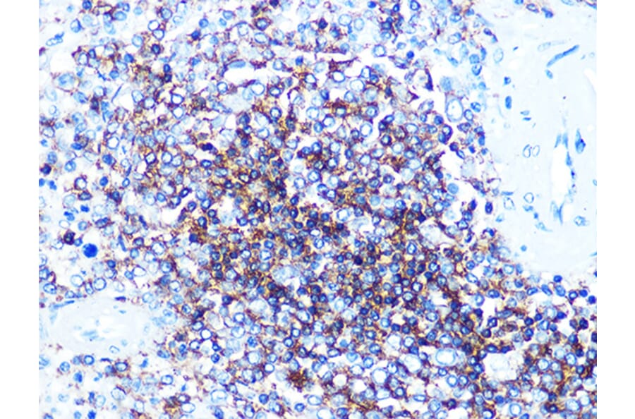 Western Blot - Anti-CD20 Antibody (A306625) - Antibodies.com
