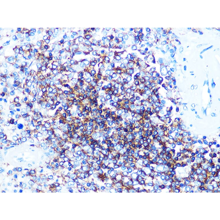 Western Blot - Anti-CD20 Antibody (A306625) - Antibodies.com
