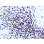 Western Blot - Anti-CD20 Antibody (A306625) - Antibodies.com