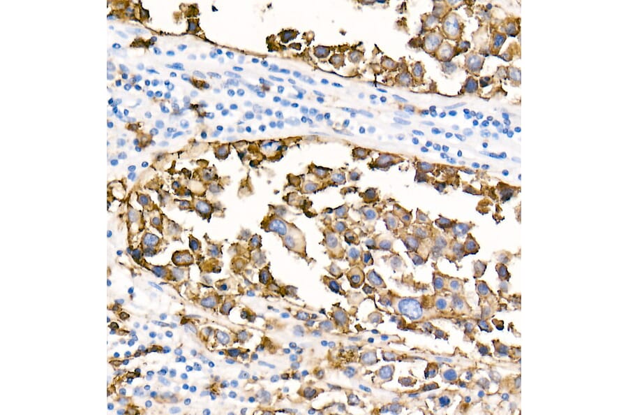 Immunohistochemistry - Anti-CD20 Antibody [ARC51683] (A306625) - Antibodies.com
