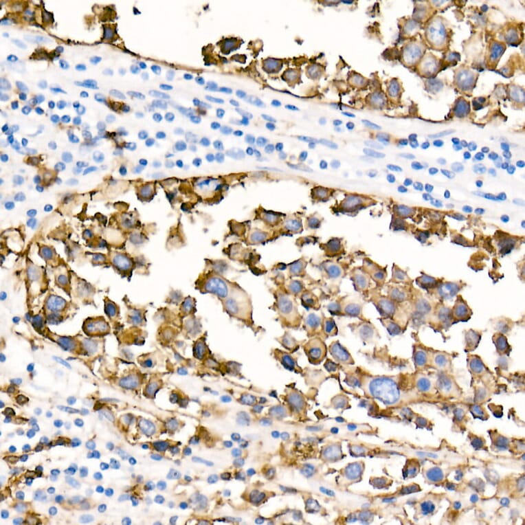 Immunohistochemistry - Anti-CD20 Antibody [ARC51683] (A306625) - Antibodies.com