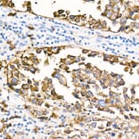Immunohistochemistry - Anti-CD20 Antibody [ARC51683] (A306625) - Antibodies.com