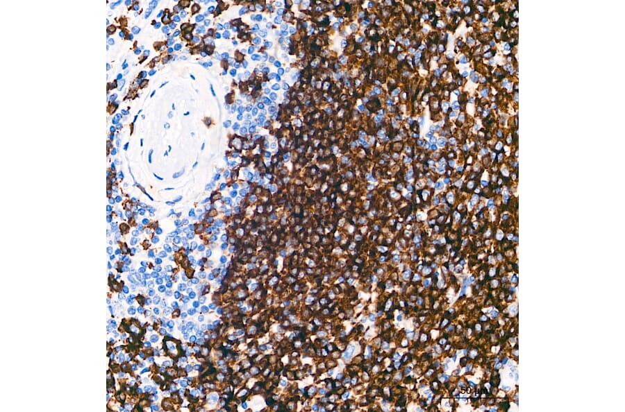 Immunohistochemistry - Anti-CD20 Antibody (A306625) - Antibodies.com