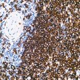 Immunohistochemistry - Anti-CD20 Antibody (A306625) - Antibodies.com