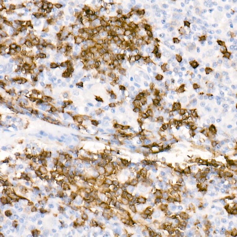 Immunohistochemistry - Anti-CD20 Antibody [ARC51683] (A306625) - Antibodies.com