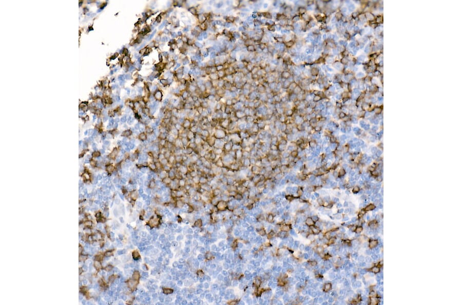 Immunohistochemistry - Anti-CD20 Antibody [ARC51683] (A306625) - Antibodies.com