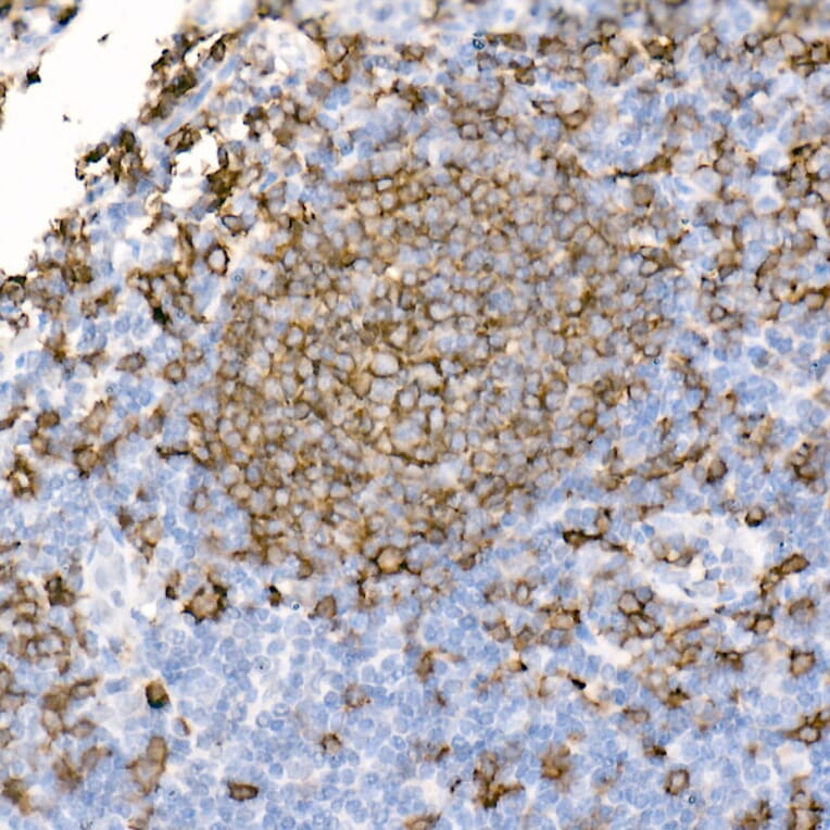 Immunohistochemistry - Anti-CD20 Antibody [ARC51683] (A306625) - Antibodies.com